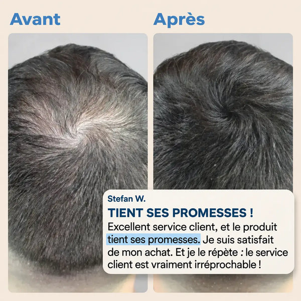 Avant/après poudre capillaire fiberhair sur cheveux gris, avis client Stefan W. « tient ses promesses »