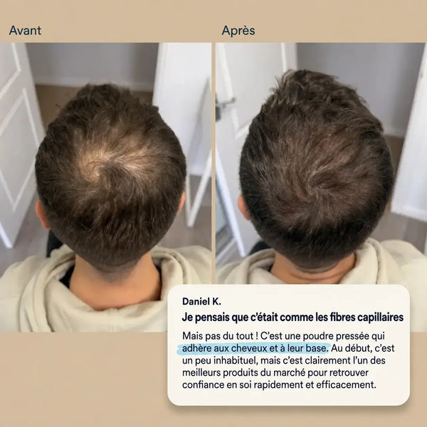 Avant/après application de la poudre capillaire fiberhair sur le sommet du crâne, avis client