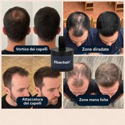 fiberhair® applicato su vortice dei capelli, zone diradate, attaccatura e zone meno folte