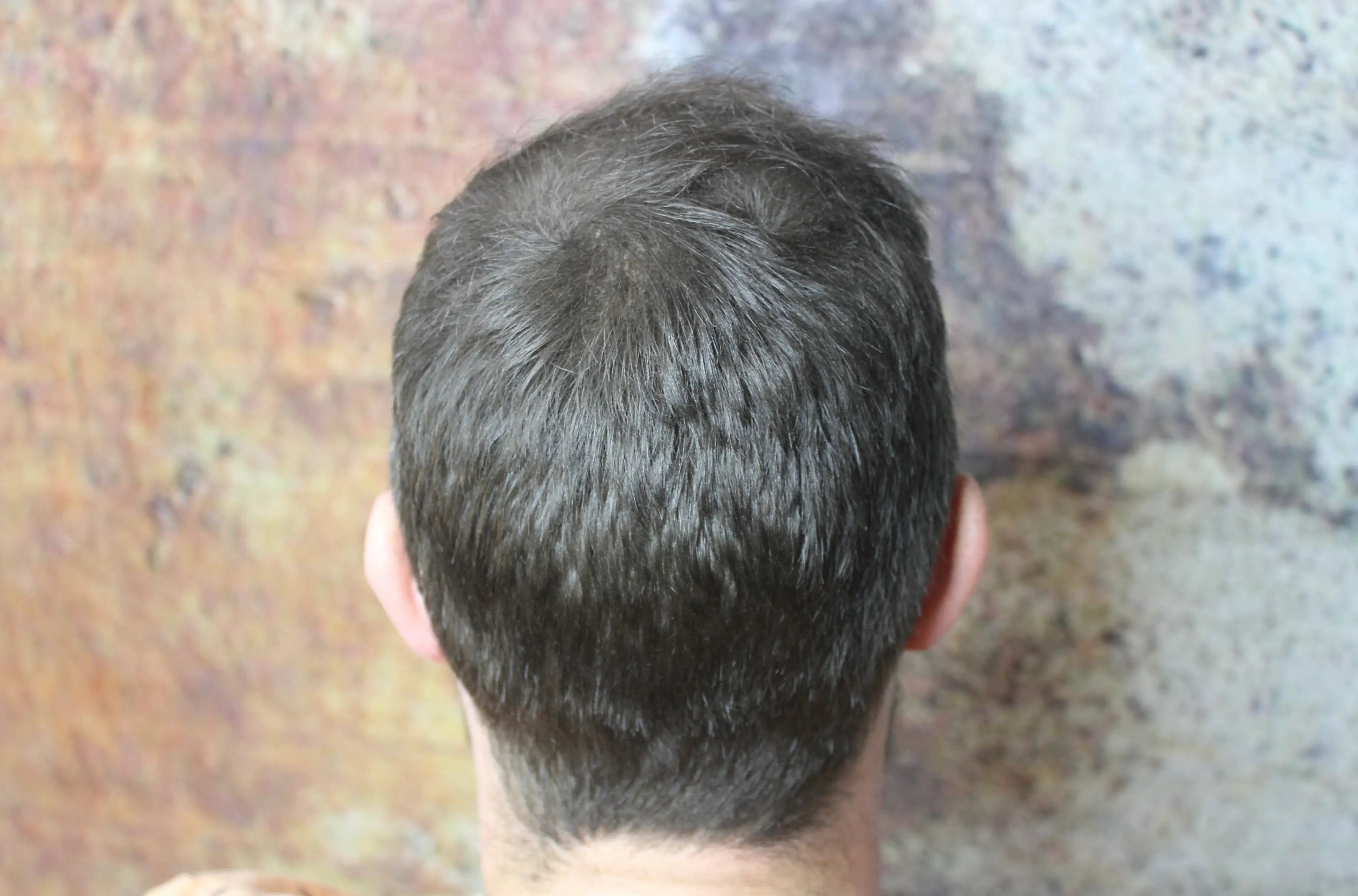 Homme montrant ses cheveux immédiatement densifiés après application du spray de poudre capillaire fiberhair aux fibres de kératine, qui couvre les zones dégarnies et les cheveux clairsemés