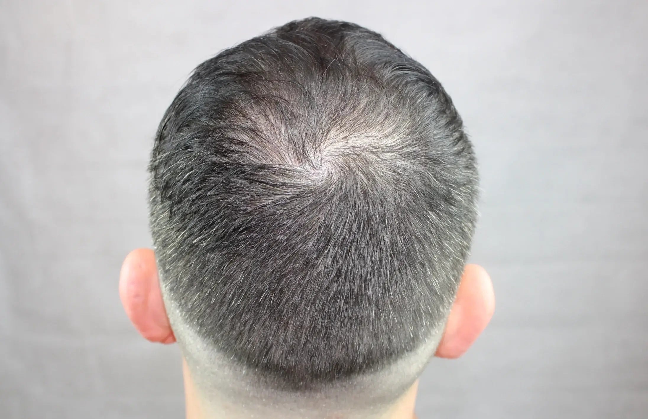 Homme souffrant de chute de cheveux et de zones dégarnies utilisant le spray de poudre capillaire fiberhair pour améliorer la densité des cheveux