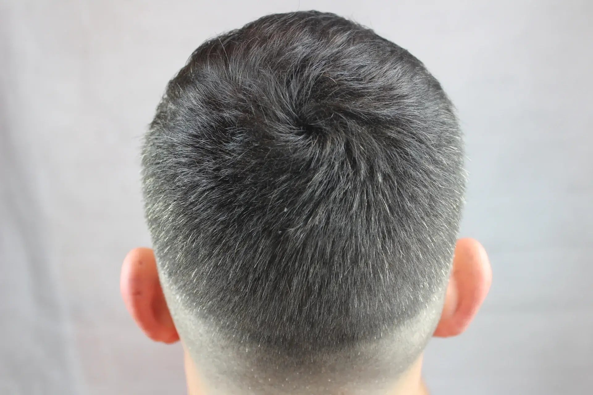 Résultat après application du spray de poudre capillaire fiberhair : homme avec un volume et une densité de cheveux nettement améliorés