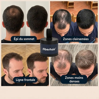 Résultats de la poudre capillaire fiberhair sur différentes zones : épi du sommet, zones clairsemées, ligne frontale, zones moins denses