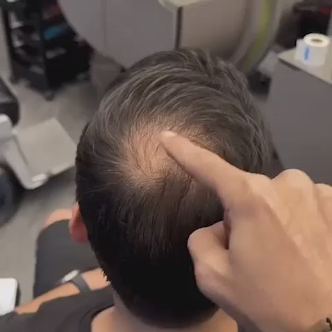 Vidéo avant/après de la poudre capillaire fiberhair qui camoufle les zones clairsemées et redonne confiance en soi
