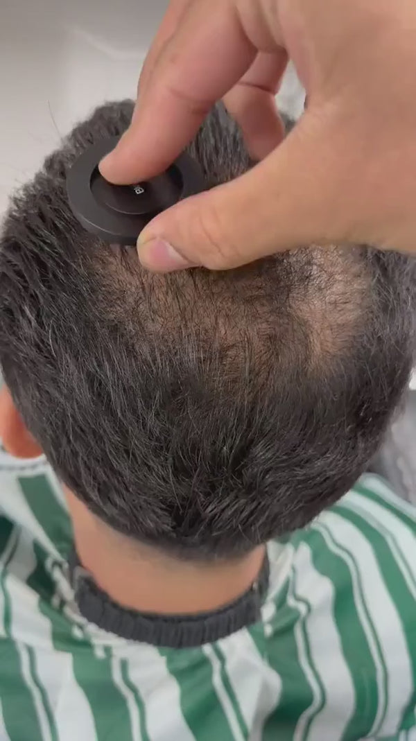 Zones clairsemées au sommet du crâne camouflées en 10 secondes avec la poudre capillaire fiberhair : avant/après
