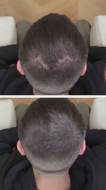 Poudre capillaire fiberhair avec miroir et applicateur : camoufle les zones clairsemées au sommet du crâne et au niveau de l'épi